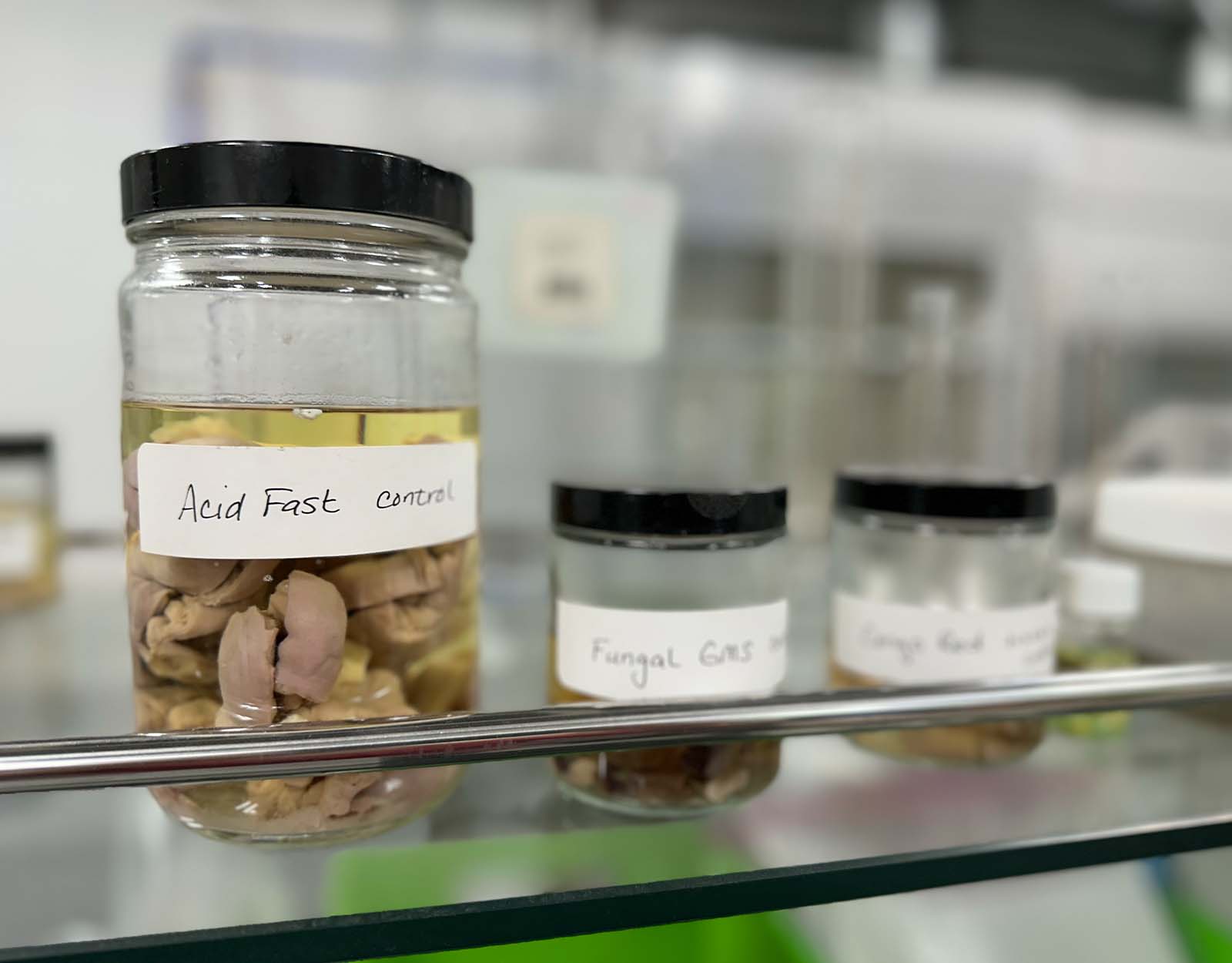 Glass jars of samples, including an "Acid Fast Control."